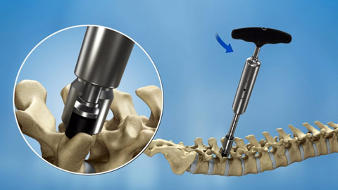 biomedical animation